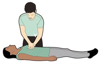 An illustration of a a man performing CPR on a casualty.