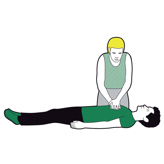 Cardiac arrest first aid - repeat compressions 30 times