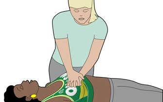 Illustration of woman receiving chest compressions