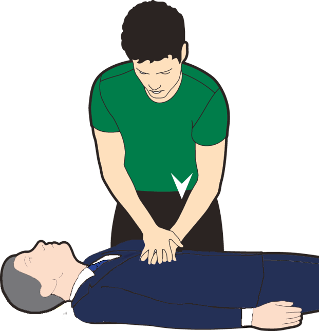 Start CPR