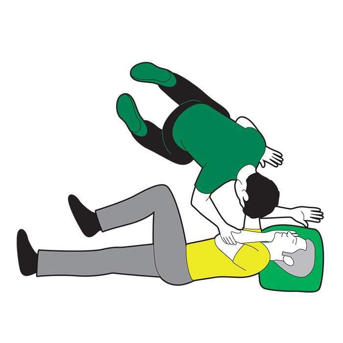 Seizures adult - monitor their level of response