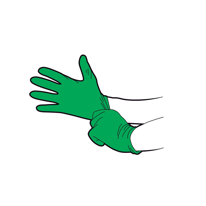 Severe bleeding first aid - wear gloves to prevent infection