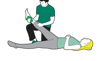 Putting ice on a strain or sprain