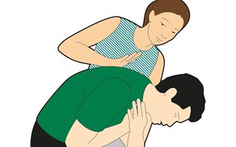 2 Choking Adult
